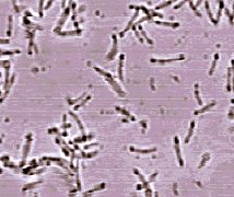Бактерии из рода Desulfitobacterium — D. hafniense (фото с сайта genome.jgi-psf.org) 
Микроорганизмы. Микробы. Одноклеточные. Микробиология. Фото. Картинки. Изображения. Рисунки. Фотографии. Текст. 
Microbes. Bacterium. Microbiology. Photo. Pictures. Text.